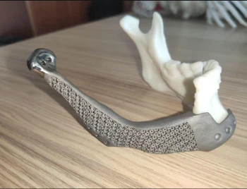 Medical Titanium: A Revolutionary Material in Healthcare